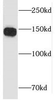 LARP1 Rabbit Polyclonal Antibody