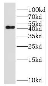LAX1 Rabbit Polyclonal Antibody