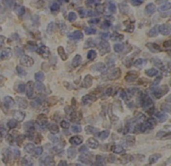 LAX1 Rabbit Polyclonal Antibody