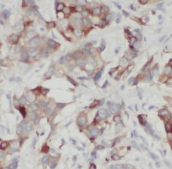 Cleaved LC3 Antibody