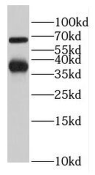 LCTL Antibody