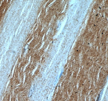 LDHA Antibody