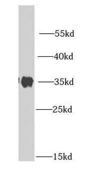 LDHB Antibody