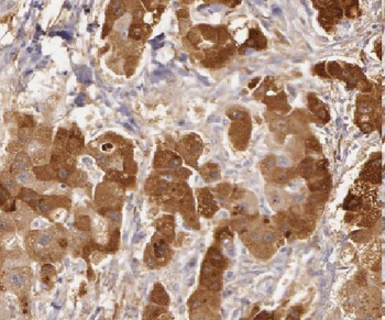 LDHD Rabbit Polyclonal Antibody