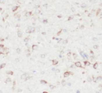 LDLR Antibody