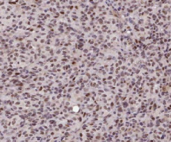 LEF1 Rabbit Polyclonal Antibody