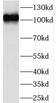 LEO1 Rabbit Polyclonal Antibody