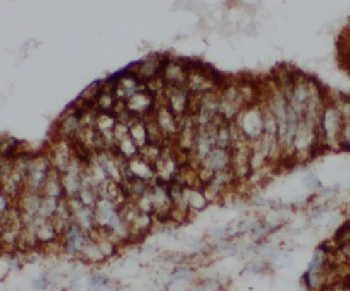 LEO1 Rabbit Polyclonal Antibody