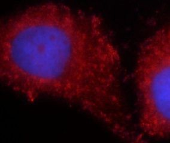 LEPR Rabbit Polyclonal Antibody