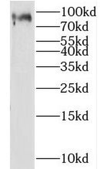 P3H3 Rabbit Polyclonal Antibody