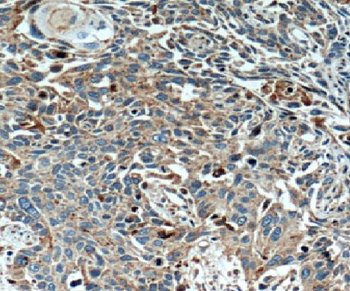 LGALS3BP Rabbit Polyclonal Antibody