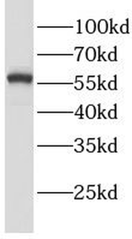 LGI3 Antibody