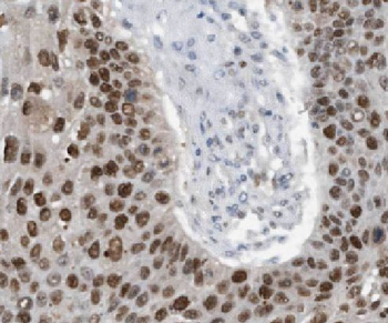 LGI3 Antibody