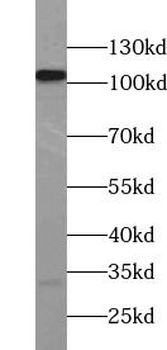 LGR6 Rabbit Polyclonal Antibody