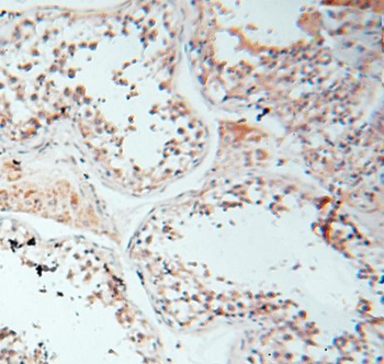 LGR6 Rabbit Polyclonal Antibody