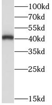 LIAS Rabbit Polyclonal Antibody