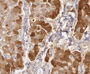 LIAS Rabbit Polyclonal Antibody