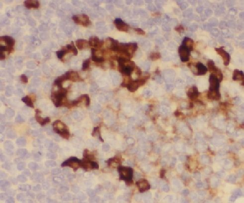 LILRA2 Rabbit Polyclonal Antibody