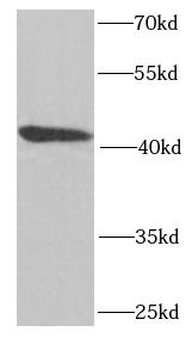 LIMS1 Rabbit Polyclonal Antibody