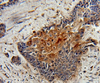 LIMS1 Rabbit Polyclonal Antibody