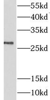 LIN28A Rabbit Polyclonal Antibody