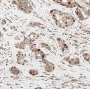 LIN28A Rabbit Polyclonal Antibody