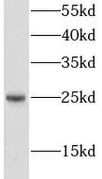 LIN7C Rabbit Polyclonal Antibody