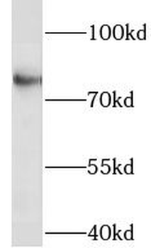 LINGO1 Rabbit Polyclonal Antibody