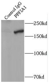 PPFIA1 Antibody