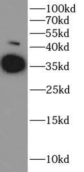 ARG1 Antibody