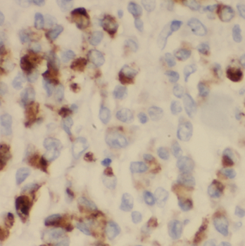 LMAN1 Rabbit Polyclonal Antibody