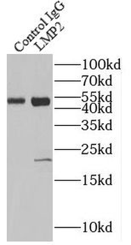 PSMB9 Antibody