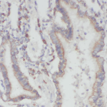 LONP1 Rabbit Polyclonal Antibody