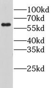 LPCAT1 Antibody