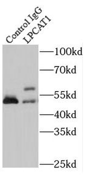 LPCAT1 Antibody