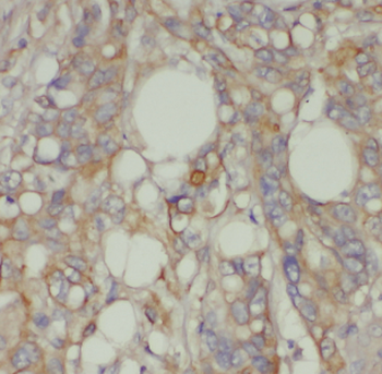 LPCAT1 Antibody