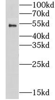 LPCAT2 Rabbit Polyclonal Antibody