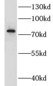 LPP Rabbit Polyclonal Antibody