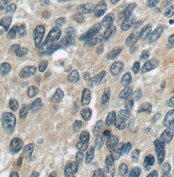 LRCH1 Antibody