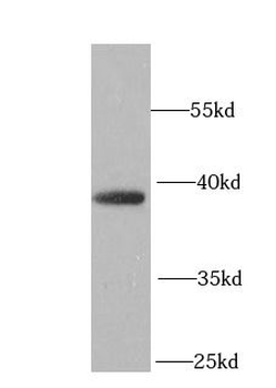 LRPAP1 Rabbit Polyclonal Antibody