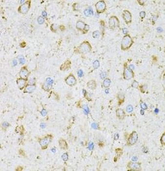 LRPAP1 Rabbit Polyclonal Antibody