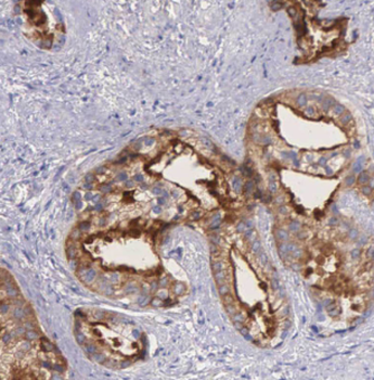 LSM1 Rabbit Polyclonal Antibody