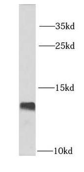 LSM2 Rabbit Polyclonal Antibody