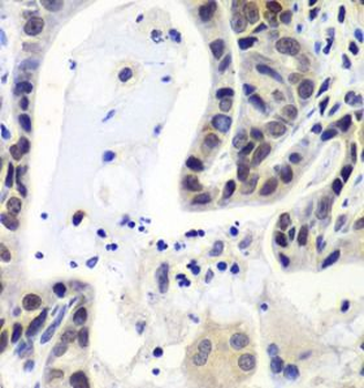 LSM2 Rabbit Polyclonal Antibody
