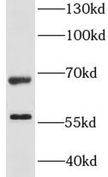 LSR Rabbit Polyclonal Antibody