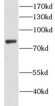 LUM Rabbit Polyclonal Antibody