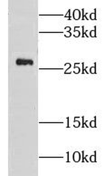 LXN Rabbit Polyclonal Antibody