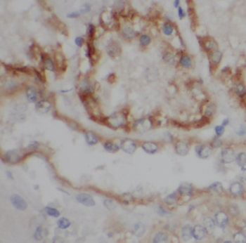 LY96 Rabbit Polyclonal Antibody