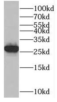 MAD2L1 Rabbit Polyclonal Antibody