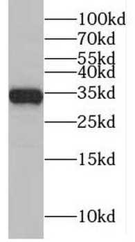 MAD2L1BP Rabbit Polyclonal Antibody